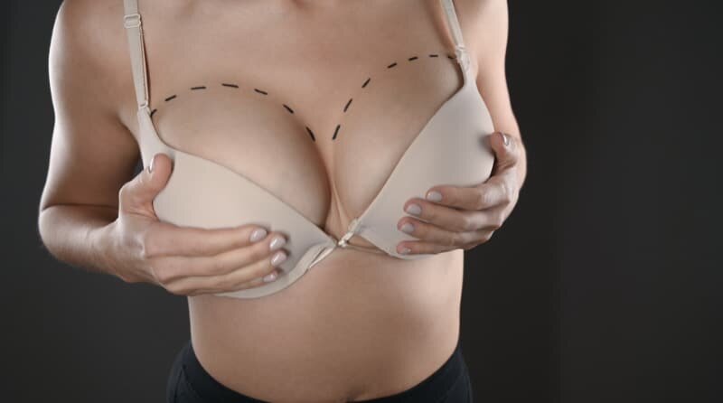 How to Enjoy a Speedy and Comfortable Breast Lift Recovery