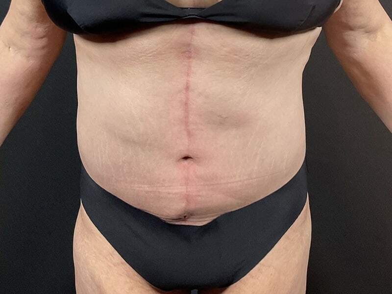 Portland Plastic Surgeon