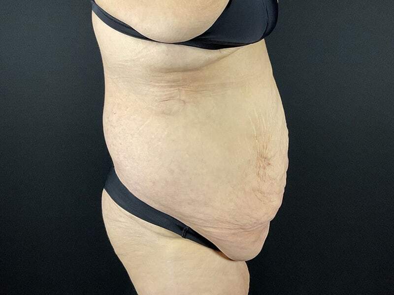 Portland Plastic Surgeon