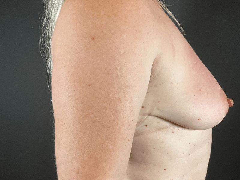 Portland Plastic Surgeon