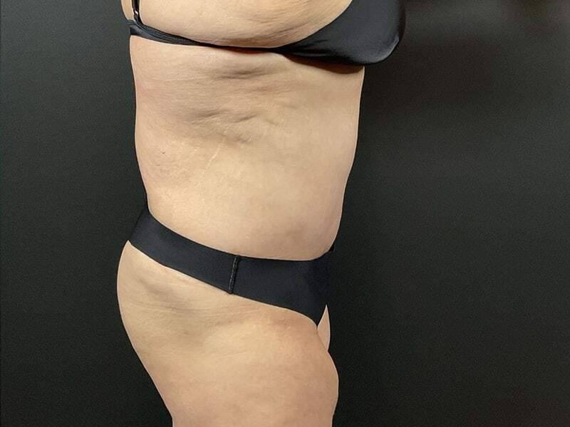 Portland Plastic Surgeon