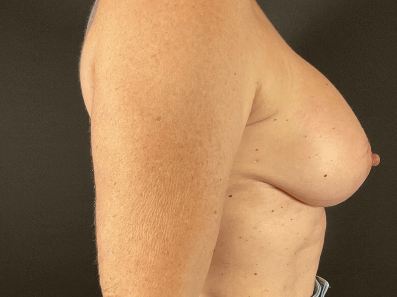 Portland Plastic Surgeon