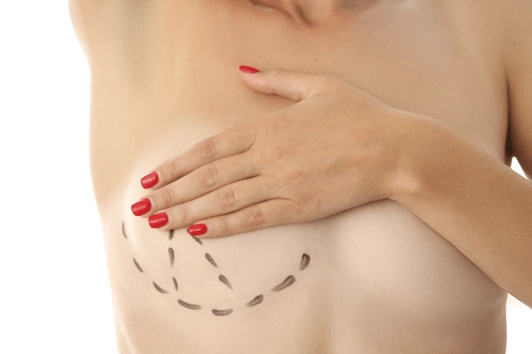 Questions To Ask Before Breast Lift