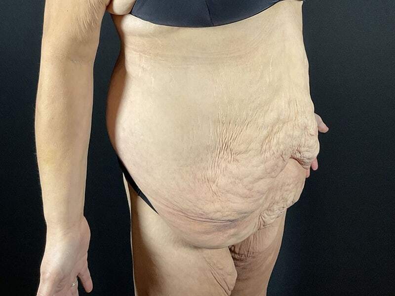 Portland Plastic Surgeon