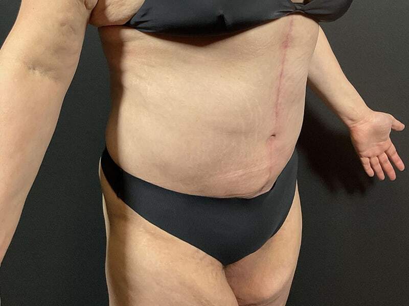 Portland Plastic Surgeon