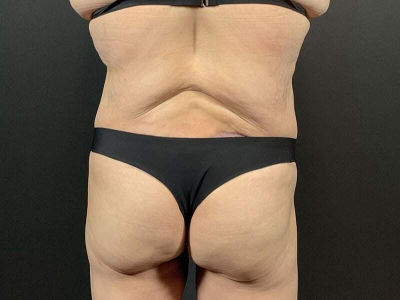 Portland Plastic Surgeon