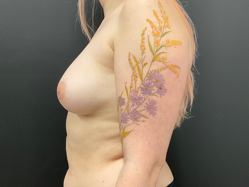 Portland Plastic Surgeon