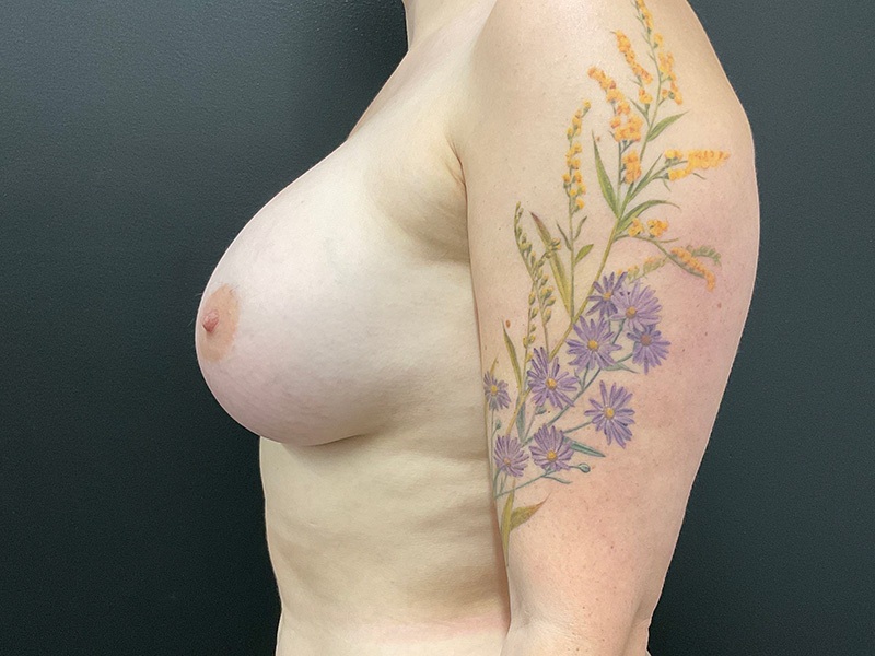 Portland Plastic Surgeon