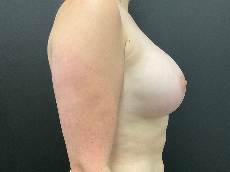 Portland Plastic Surgeon