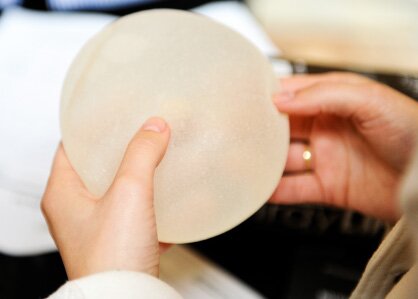 Questions to ask before breast implants