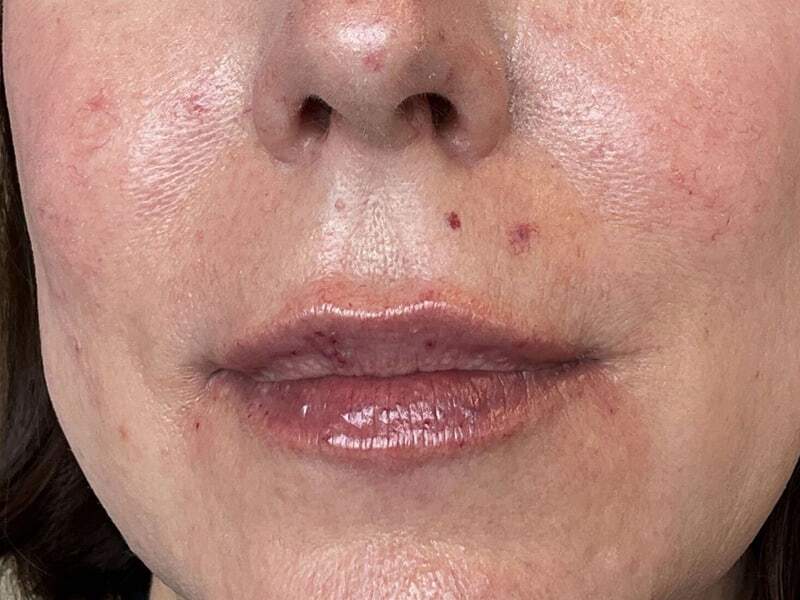 Portland Plastic Surgeon