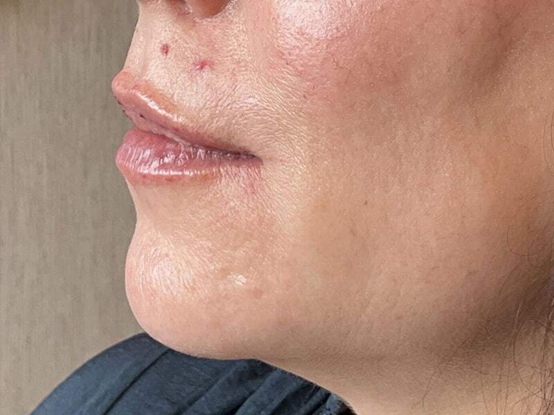 Portland Plastic Surgeon