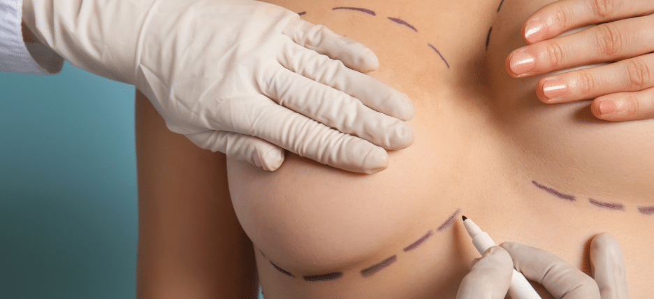 How Much Does a Breast Lift Cost?