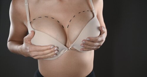 Will I regret my breast lift