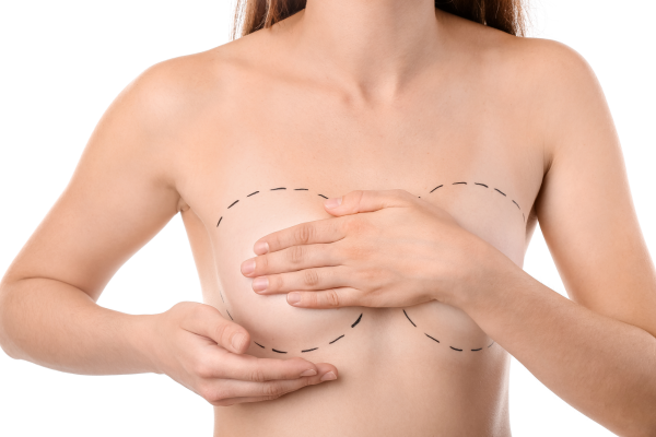 Recovery Time For Breast Implant Revision Surgery