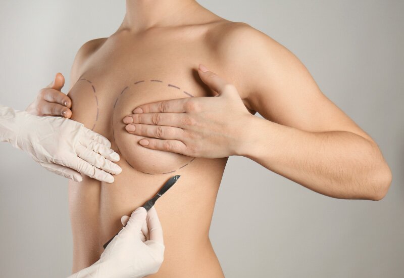 Breast Augmentation Risks and Considerations