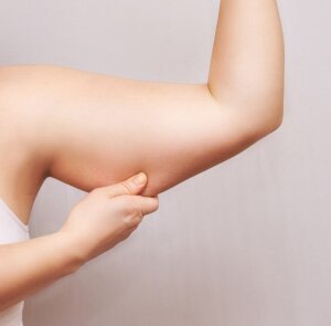 Is arm liposuction worth it