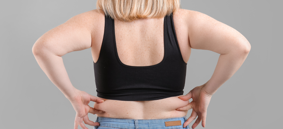 What If I Have Lower Body Lift Regrets?