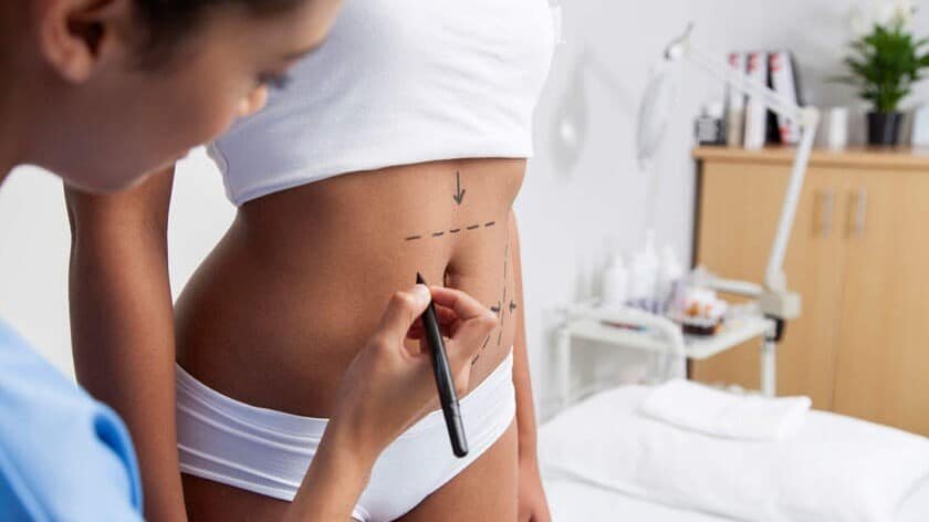 What Liposuction Areas Can Be Treated On The Body?
