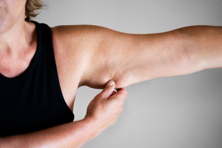 Liposuction body parts