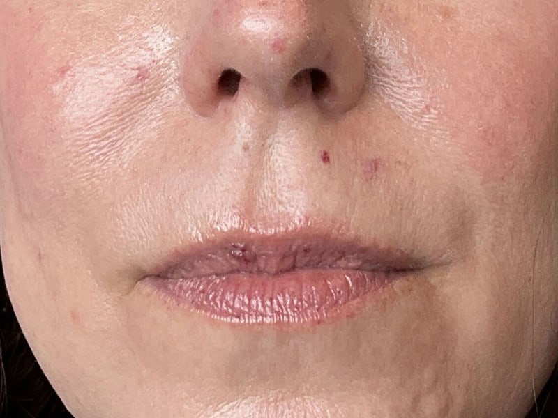 Portland Plastic Surgeon
