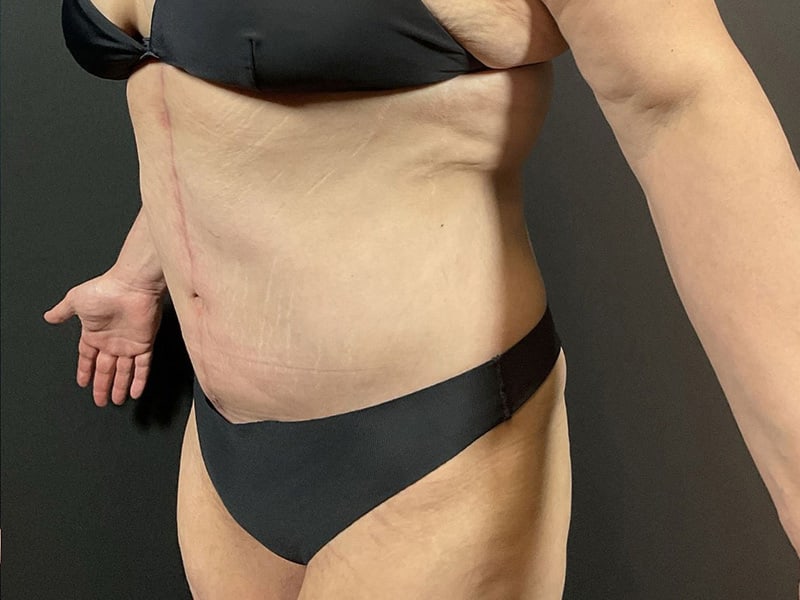 Portland Plastic Surgeon