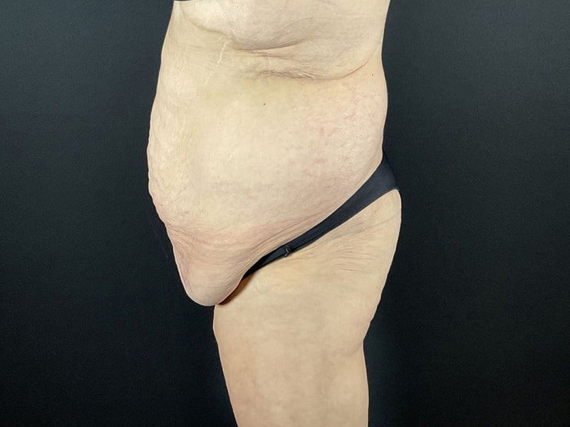 Portland Plastic Surgeon