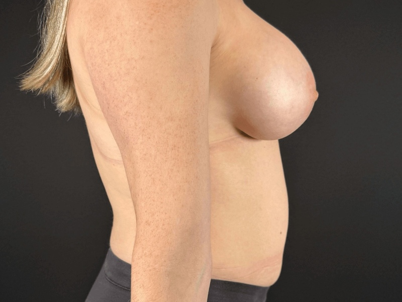 Portland Plastic Surgeon